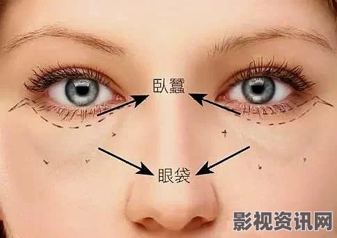 瞎的眼睛位置不对